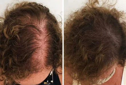 Resultado 1 - Antes e Depois