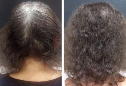 Resultado 2 - Antes e Depois