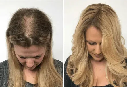 Resultado 3 - Antes e Depois